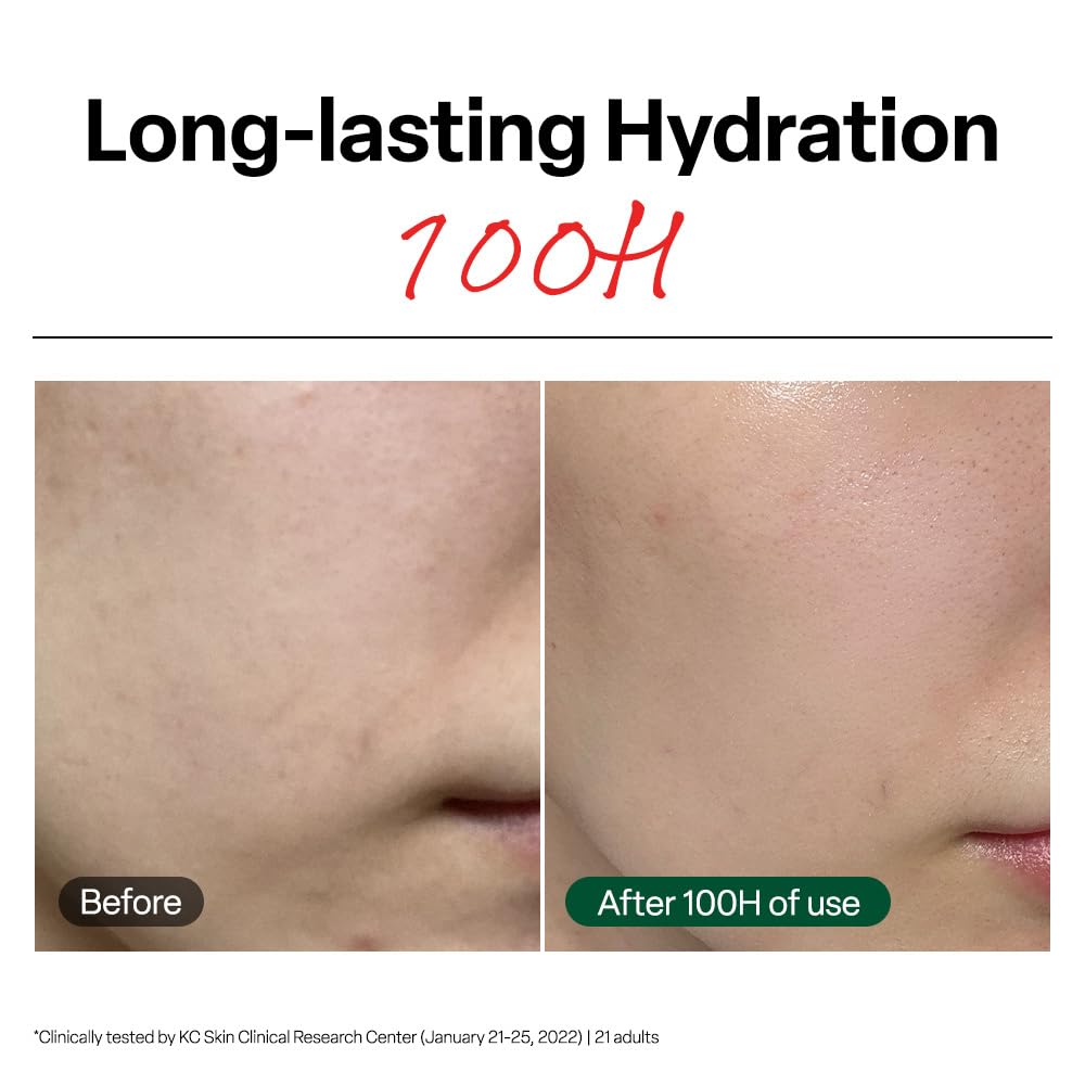 Dr. G R.E.D. Blemish Clear Soothing Cream - Calming Korean Moisturizer for Redness - Soothes Acne & Irritation - With Centella Asiatica - Long-Lasting Hydration - 2.36 fl oz
