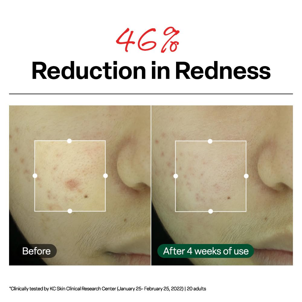 Dr. G R.E.D. Blemish Clear Soothing Cream - Calming Korean Moisturizer for Redness - Soothes Acne & Irritation - With Centella Asiatica - Long-Lasting Hydration - 2.36 fl oz