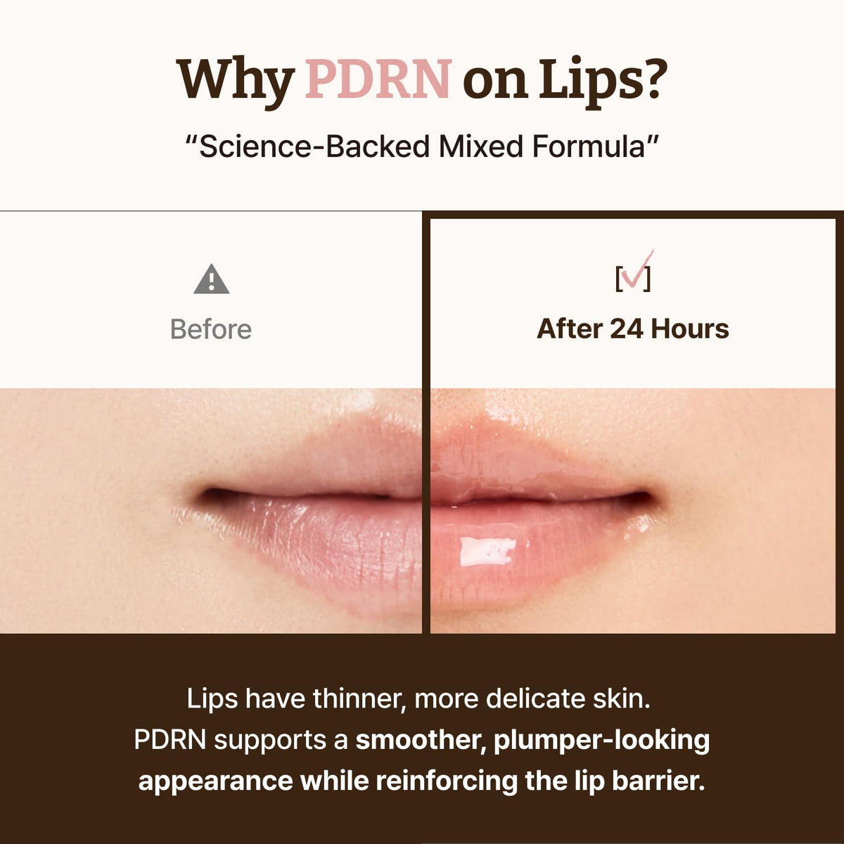 Dr.Reju-All Advanced PDRN Rejuvenating Lip Serum – Hydrating Lip Balm with Lipozip PDRN for Glowy, Dewy Lips – Gentle Exfoliating & Smoothing Lip Moisturizer – Hibiscus & Lactic Acid – 0.3 Fl Oz