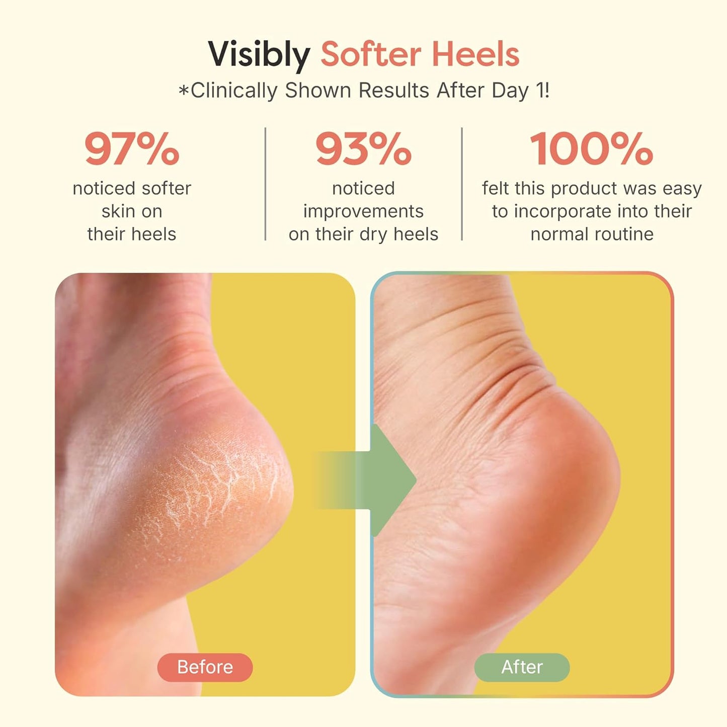 ZenToes Moisturizing Socks for Cracked Heel Treatment, Vitamin E, Olive Oil and Jojoba Oil Infused Heel Socks, Spa Gifts for Women, Relaxation Gifts for Women (Fuzzy Lilac Purple, Regular)