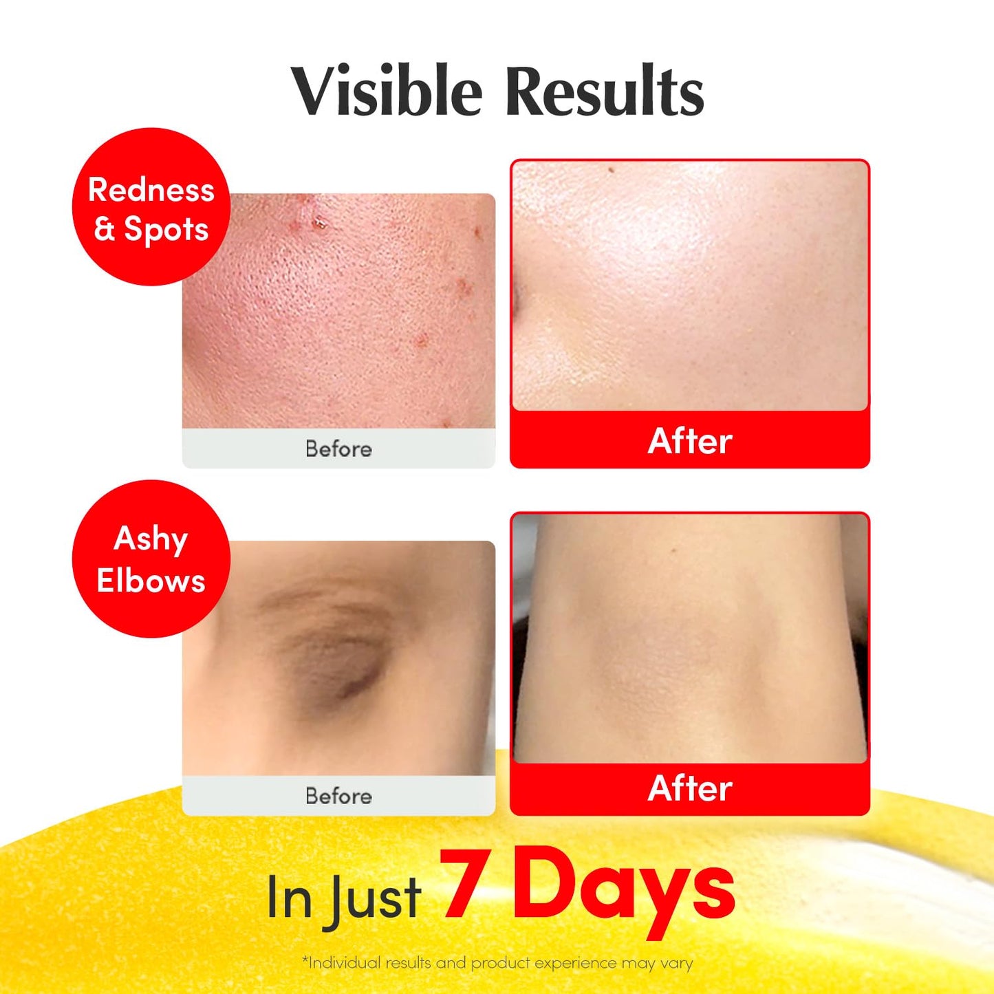 EQQUALBERRY Vitamin Illuminating Serum | Niacinamide 4% + Brightening Vitamin C Face Glow Serum with Hyaluronic Acid & Vitamin E | Dark Spot, Uneven Tone Care | Korean Skincare (1.01oz * 2ea)