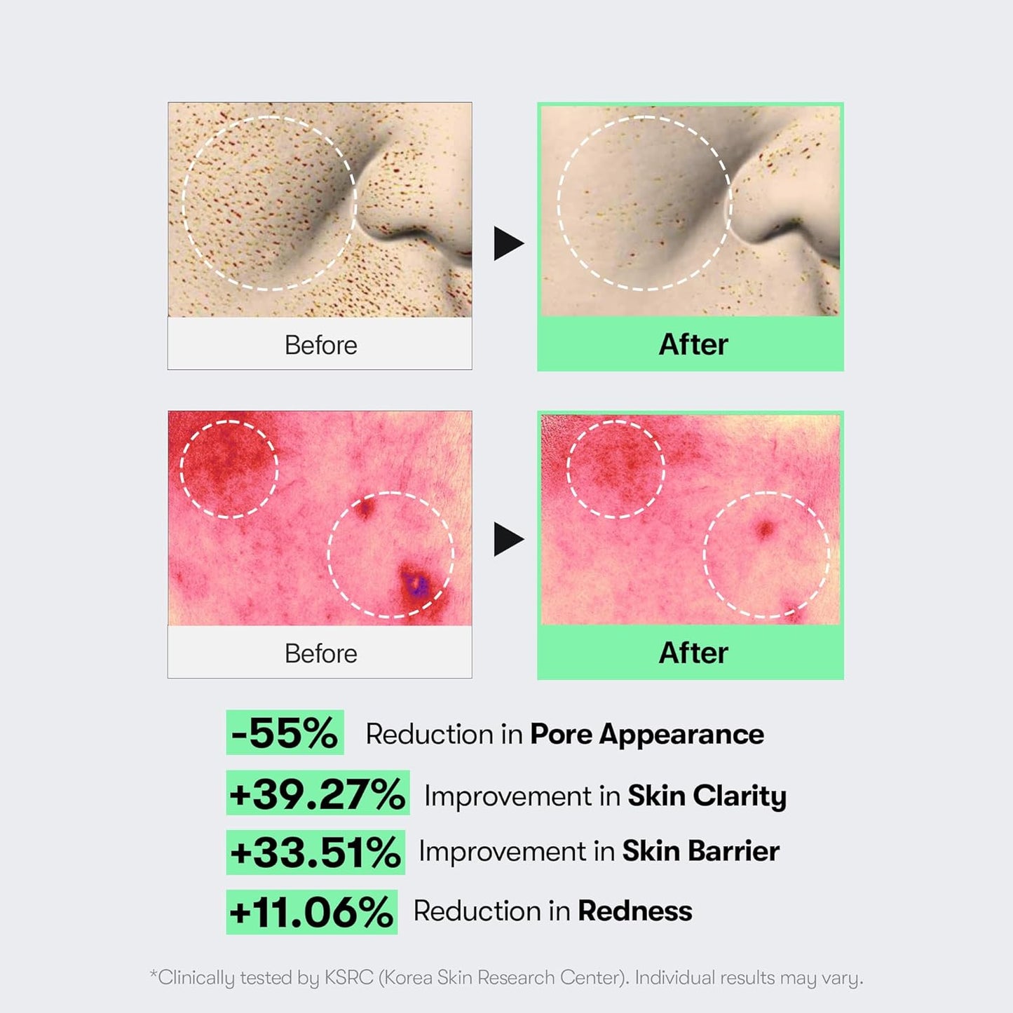 VT COSMETICS CICA Reedle Shot 100, Spicule Microneedling Serum for Pore Care & Exfoliation, Exosome, Centella Asiatica for Glass Skin, Skin Texture, Korean Liquid Skin Booster (1.69 Fl Oz / 50ml)