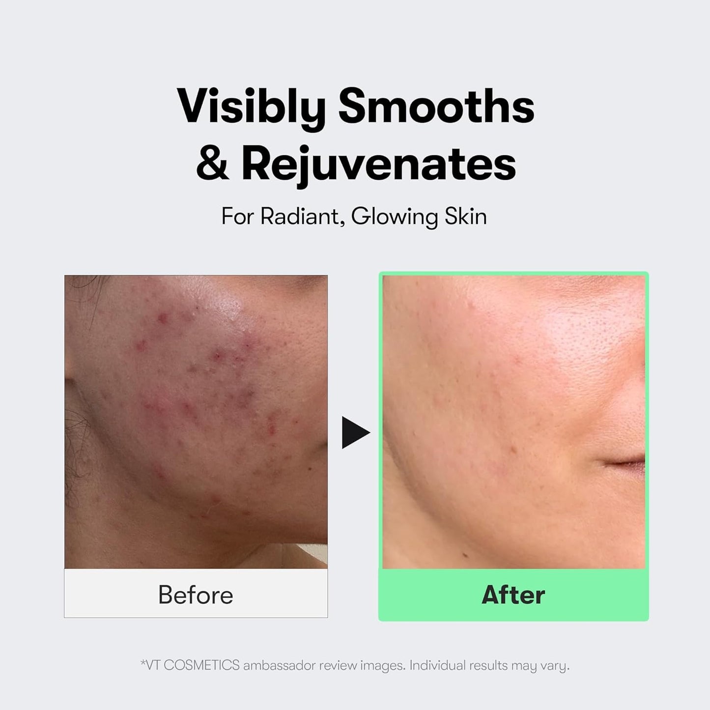 VT COSMETICS CICA Reedle Shot 100, Spicule Microneedling Serum for Pore Care & Exfoliation, Exosome, Centella Asiatica for Glass Skin, Skin Texture, Korean Liquid Skin Booster (1.69 Fl Oz / 50ml)