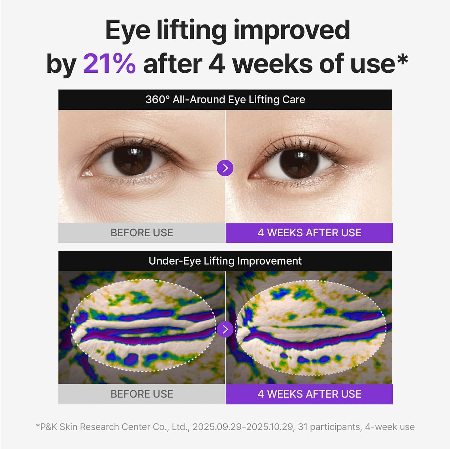 CENTELLIAN 24 360º Shot PDRN Eye Cream - Anti-Aging Retinol Eye Cream for Hooded Eyes, Firming & Wrinkle Smoothing, Hydrating Care for Dark Circles, Under-Eye Bags & Crow's Feet, 1.01 fl oz