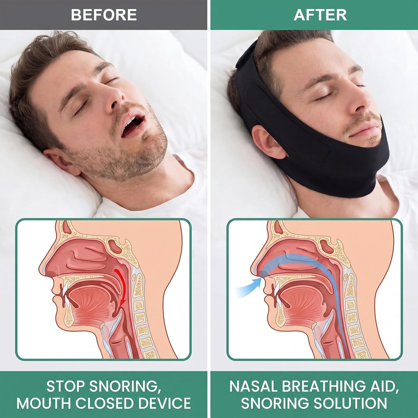Anti Snoring Chin Strap for Sleeping – Adjustable, Breathable & Comfortable Snore Stopper Device for Men & Women – Effective Mouth Tape Alternative for Better Sleep & Apnea Relief (Black)