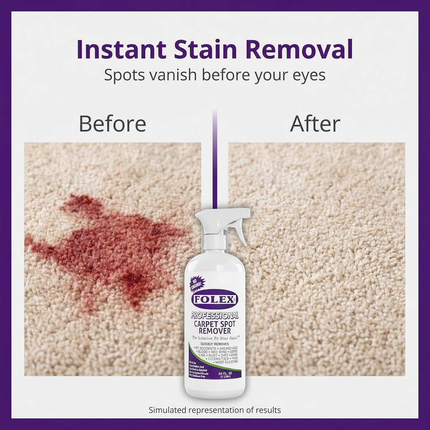 FOLEX - Professional Carpet Cleaner Spray 34 oz - Pet Stain Removal - Instant Stain Removal - No Rinsing Required - Safe for Pets - Works on All Fabrics