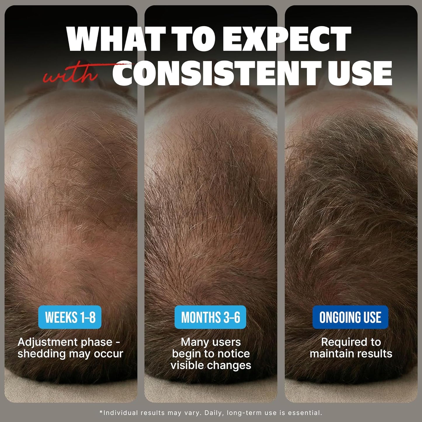 Kirkland Minoxidil for Men Liquid, Extra Strength Hair Regrowth Treatment 5%, 6 Months Supply - Upgraded Dropper Applicator and Bonus Free Guide Included